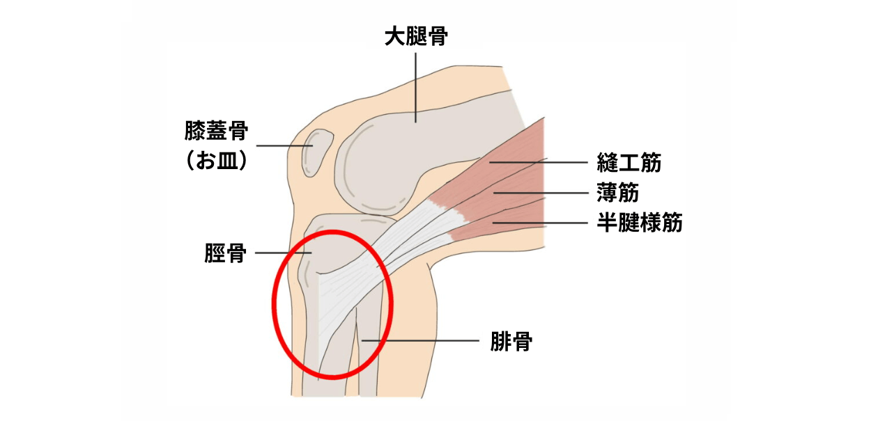 鵞足炎の図解